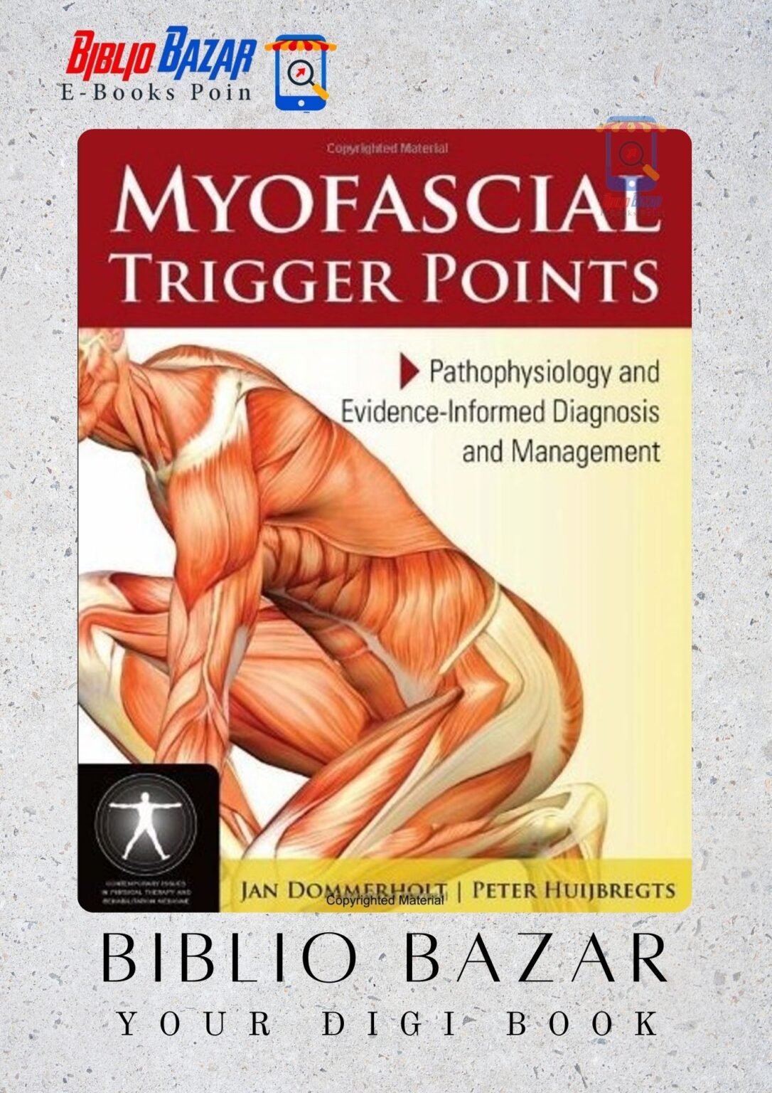 Understanding Myofascial Trigger Points: Pathophysiology, Diagnosis ...