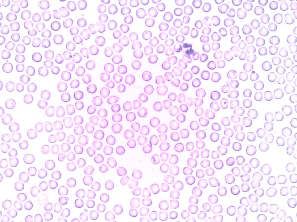 erythrocyte