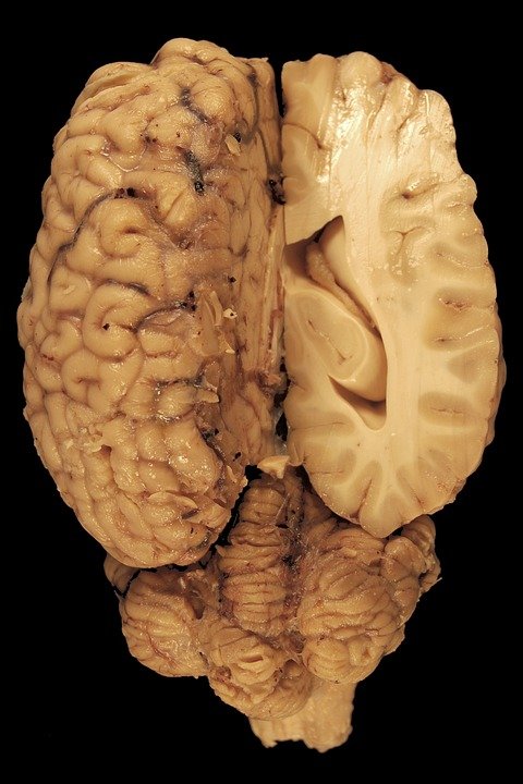 cerebrum