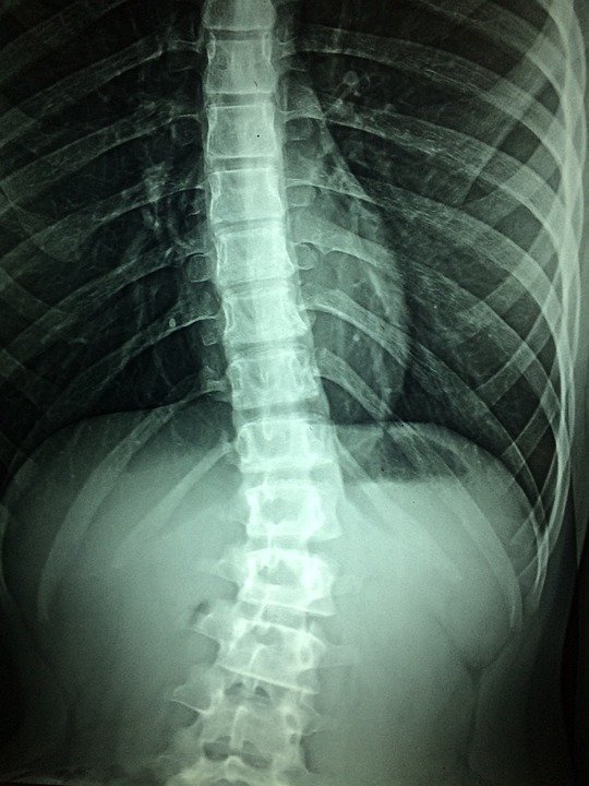 spinal cord