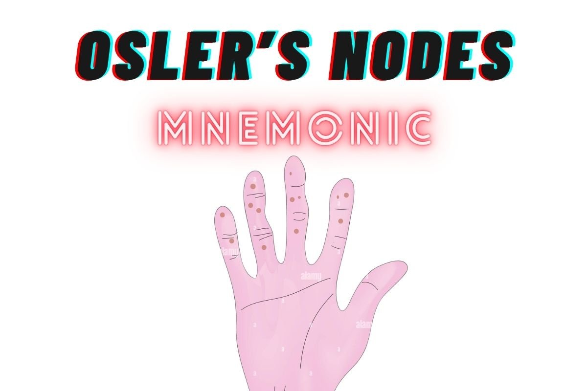 Osler's Nodes Mnemonic [Easy to remember] - Bibliobazar Digi Books