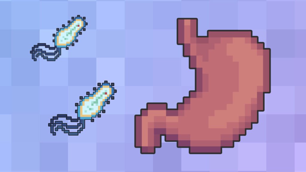 Peptic Ulcer Disease | H. pylori | Management